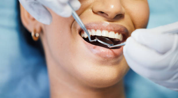 Best Emergency Dental Care for Abscessed Tooth in Shady Hills, FL